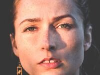 멜라닌 관리 방법 색소 생성의 원인