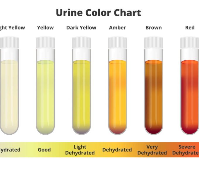 소변색 노란색, 갈색, 탁함의 건강상태 및 색깔이 변하는 이유