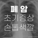 폐암 초기증상, 손톱 색깔으로 확인하는 방법 및 조기 예방방법 34 폐암 초기증상 손톱색깔