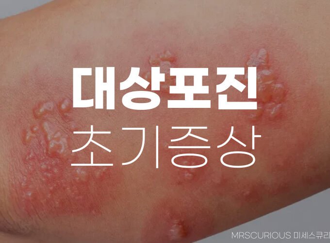대상포진 초기증상 후유증