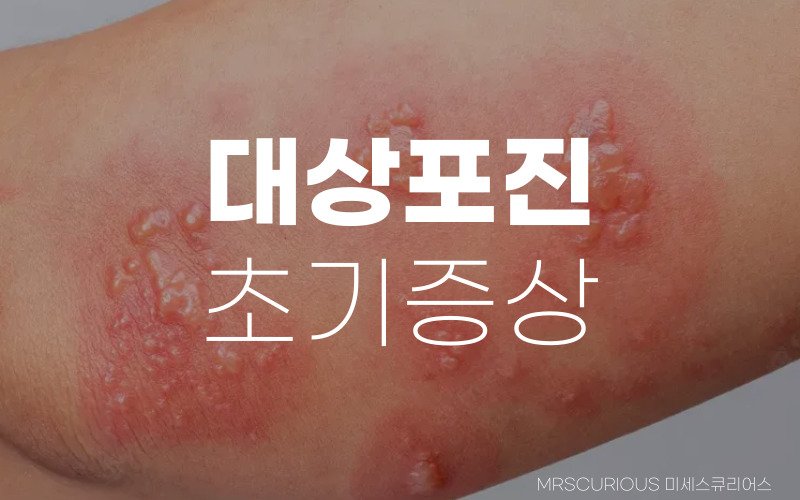 대상포진 초기증상, 후유증 및 회복기간 자세히 알아보기 1 대상포진 초기증상 후유증