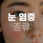 눈 염증 종류 및 치료법 그리고 좋은 음식 BEST 5 6 눈 염증 종류