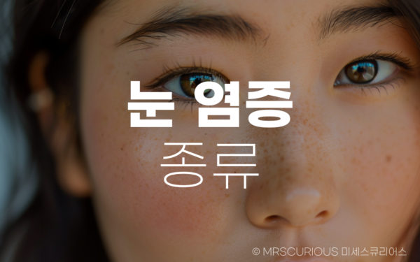 눈 염증 종류 및 치료법 그리고 좋은 음식 BEST 5 10 눈 염증 종류