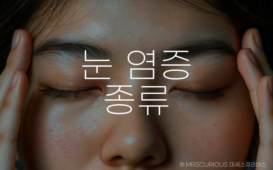 눈 염증 종류 및 치료법 그리고 좋은 음식 BEST 5 2 눈 염증 종류 증상