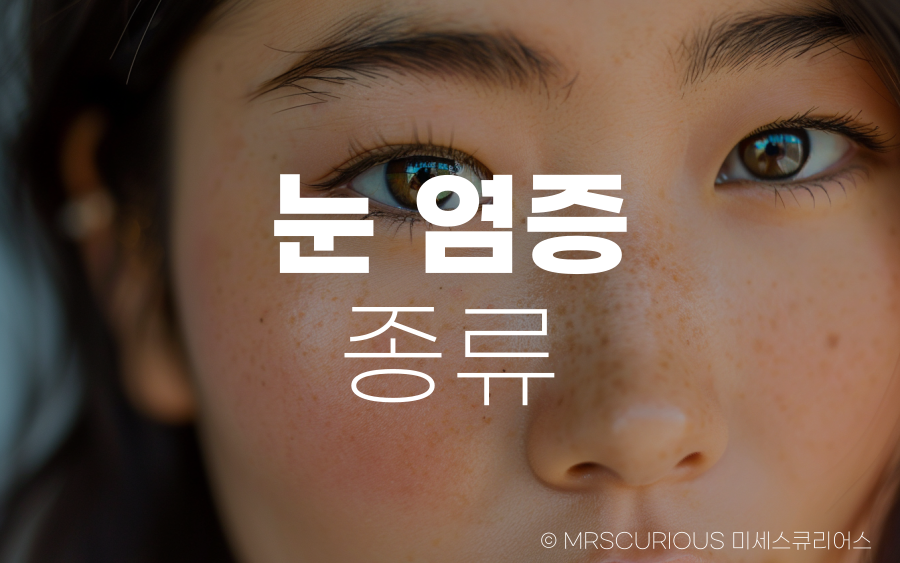 눈 염증 종류 및 치료법 그리고 좋은 음식 BEST 5 1 눈 염증 종류