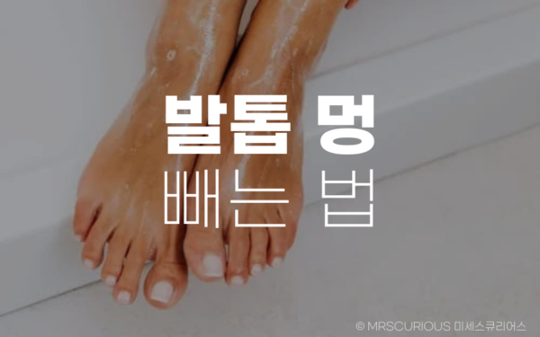 발톱 멍 빼는 법 그리고 생기는 원인과 증상에 대해 알아보기 12 발톱 멍 빼는 법
