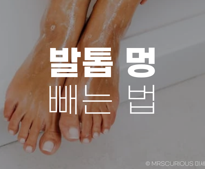 발톱 멍 빼는 법