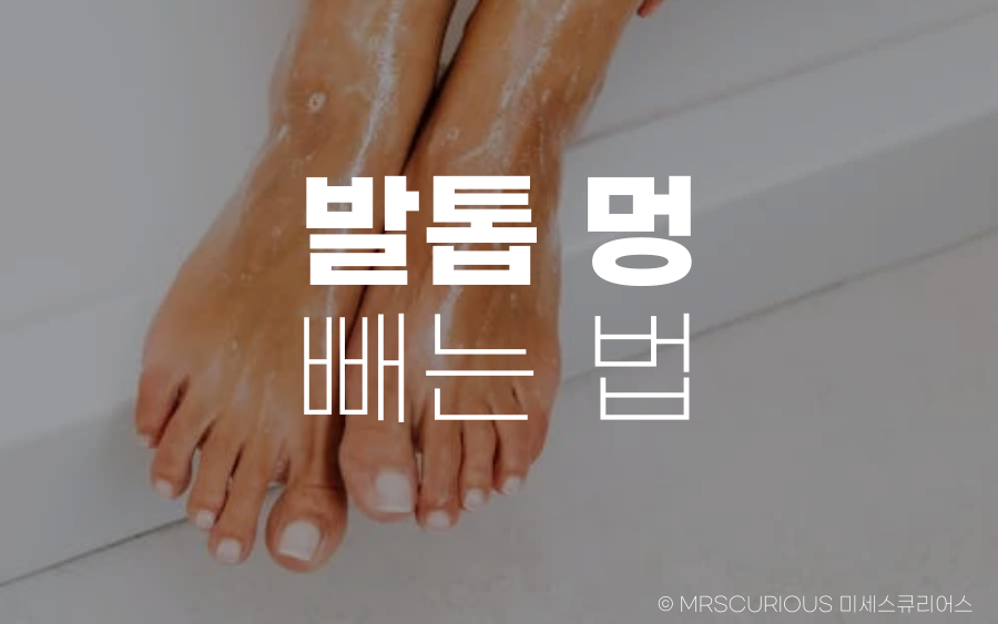 발톱 멍 빼는 법 그리고 생기는 원인과 증상에 대해 알아보기 1 발톱 멍 빼는 법
